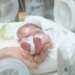 З 22 тижнів: як відбувається виходжування передчасно народжених дітей